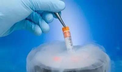 液氮存储